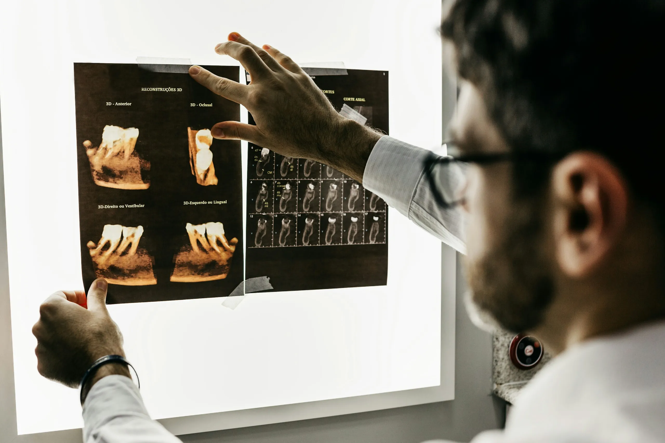 An orthodontist pointing at dental X-rays on a screen